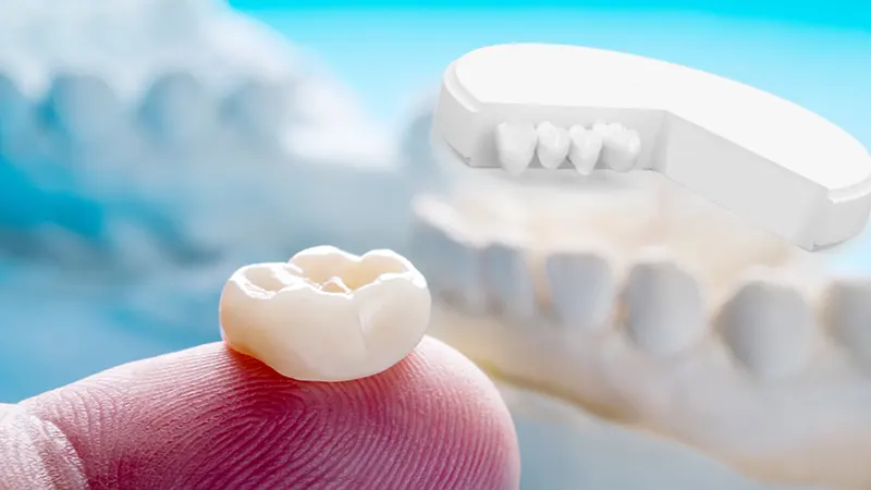 Monolitik Zirkonyum Fiyatları Ankara